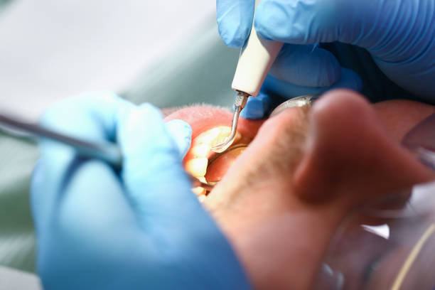 Best Orthodontic Emergency Dentist in Lacoochee, FL